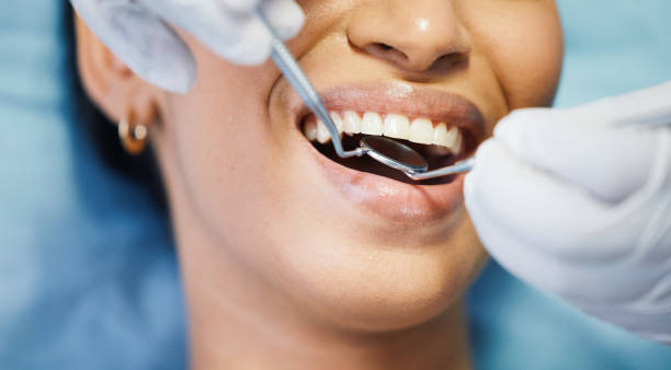 Best Teeth Whitening  in Leavenworth, KS