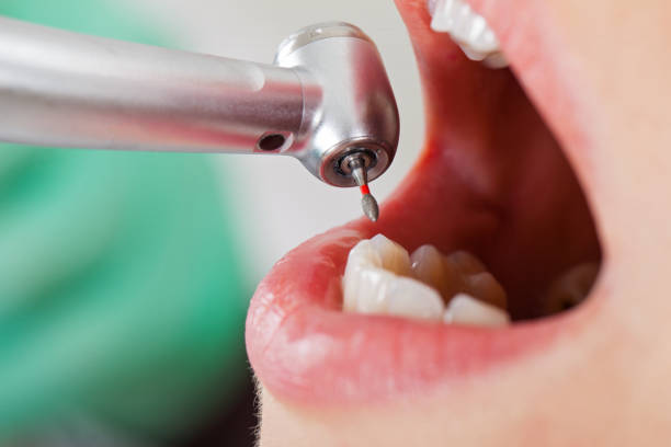 Best Emergency Tooth Extraction  in Leavenworth, KS
